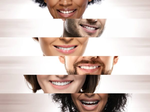 Cosmetic dentistry vs general dentistry